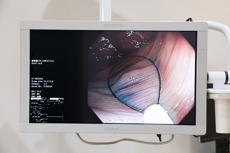 高解像の画像が微細な粘膜の変化も見逃さない。SONY製有機ELディスプレイ